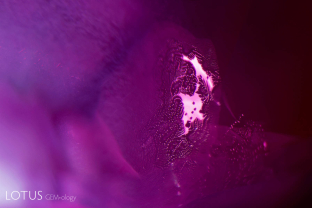 Mong Hsu rubies are generally heat treated to remove the blue cores that darken their color. In addition, most contain open fissures that disfigure the gems. Treaters use fluxes like borax to heal the fissures with microscopic amounts of synthetic ruby, which recrystallizes in the cracks. This photo shows a flux-healed fissure, accompanied by a cottony cloud of diaspore silk.