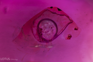 This round gas bubble is suspended in a small cavity on a Burmese ruby which has some filler substance (this could be resin or oil). Oil is often used to mask the appearance of fissures and cavities.