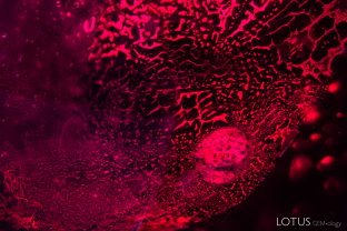 “Saturn inclusion” type crystals, as seen here, are a hallmark of Thai/Cambodian ruby. Although we were unable to identify the composition of the whole crystal, the black spots on the surface were identified as magnetite with micro Raman.